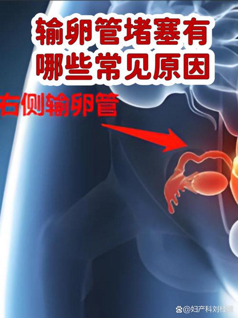 不孕不育治疗:一场与生命共舞的马拉松