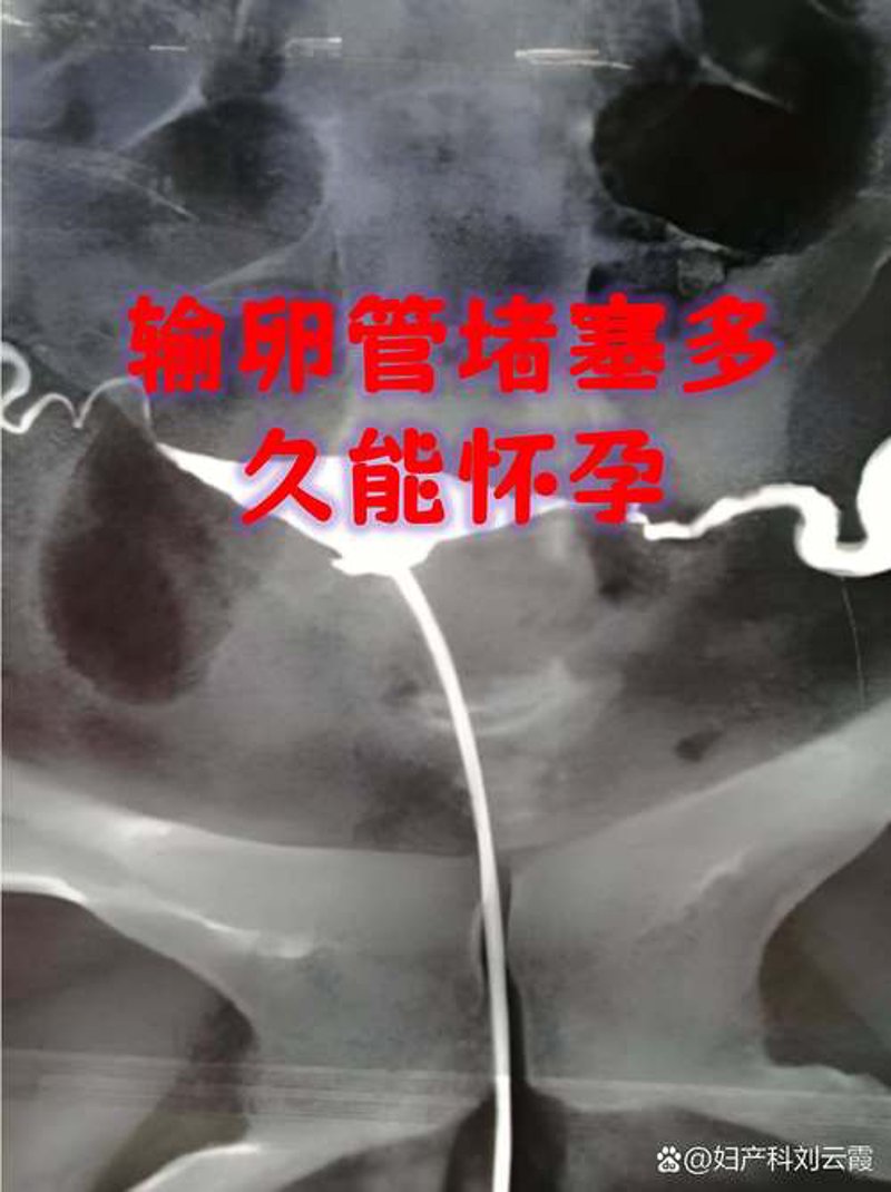 探索男性不育的秘密：一次全面检查的必要性